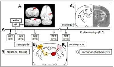 Modeling Vestibular Compensation: Neural Plasticity Upon Thalamic Lesion